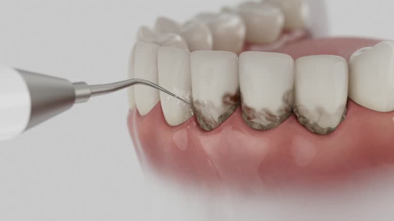 Trusted Tooth Extraction service in Verdigris, OK - Dentist Open Now